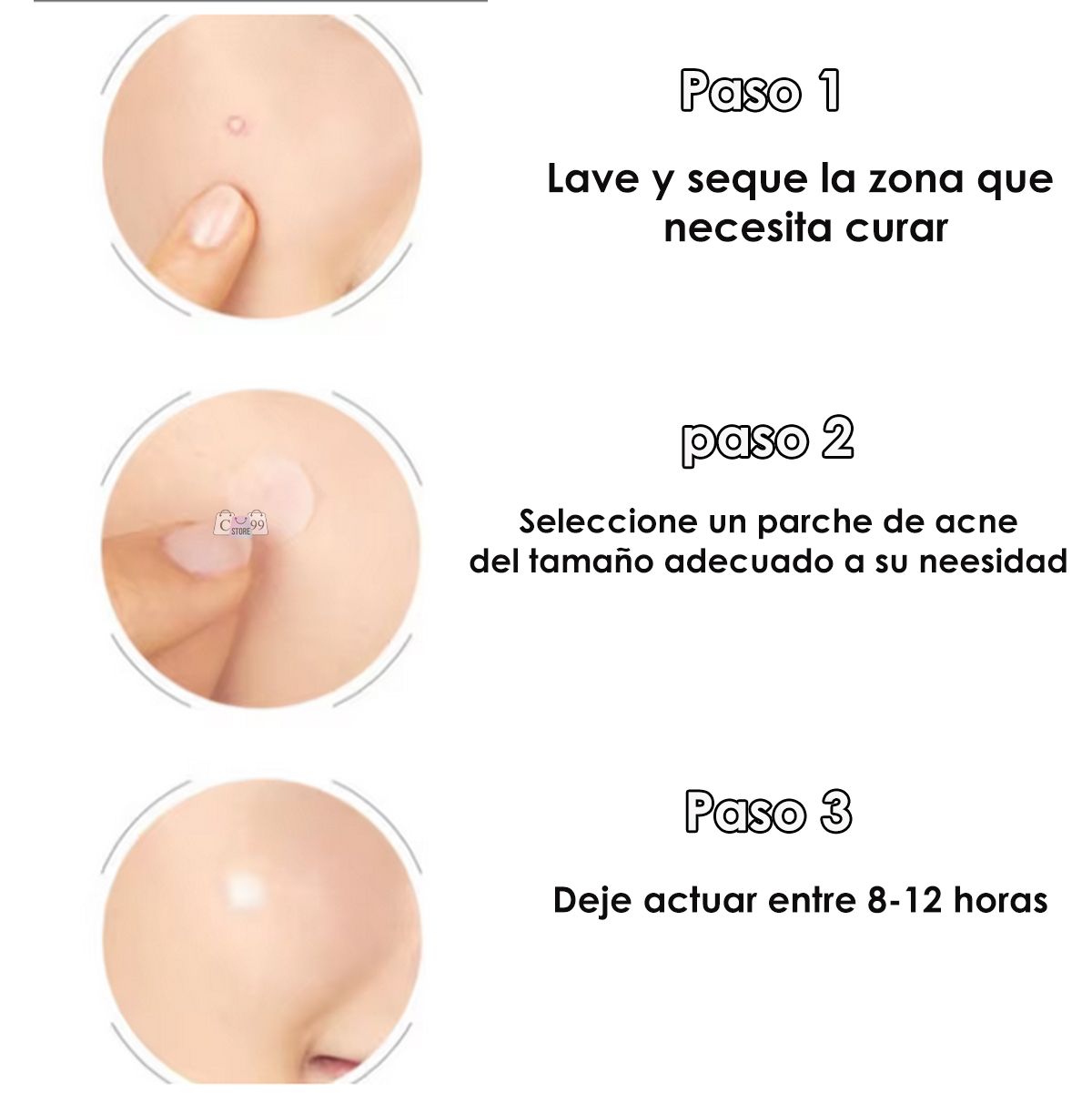 Miniatura 5 de Parche Para Acné y Espinillas Sticker